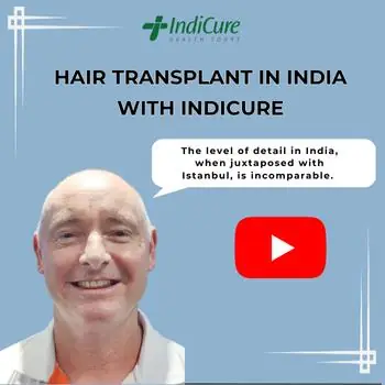 Best Hair Transplant in India